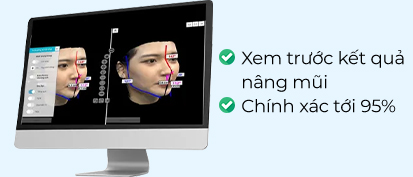 Ứng dụng công nghệ Ai Face Design trong phân tích và tạo dáng mũi
