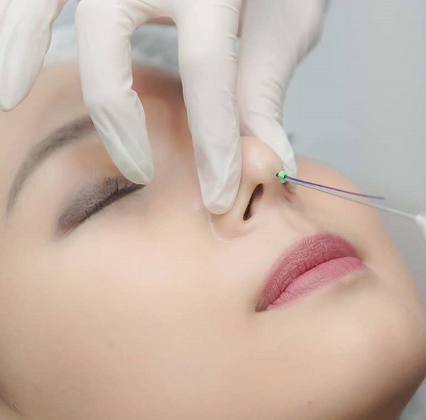 Current trends in beautiful nose shapes for rhinoplasty các dáng mũi đẹp