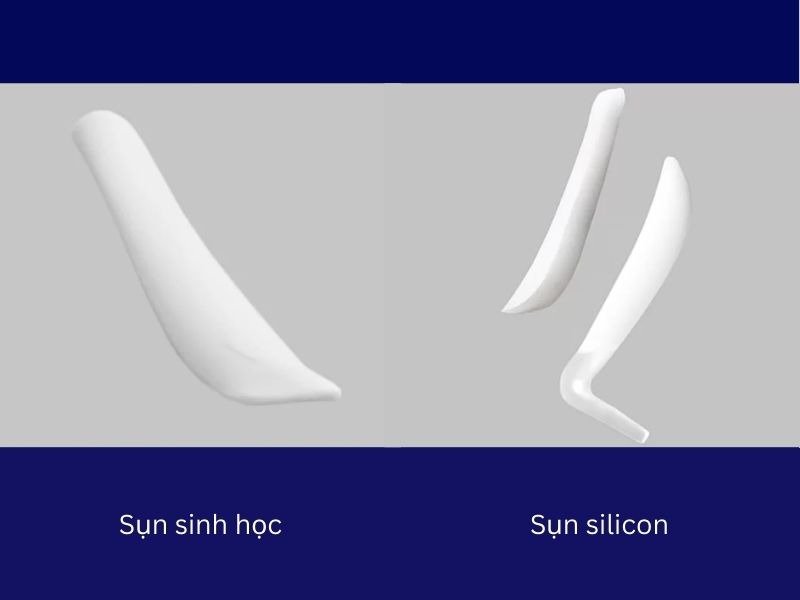 Common types of nasal cartilage implants currently available Các loại sụn nâng mũi