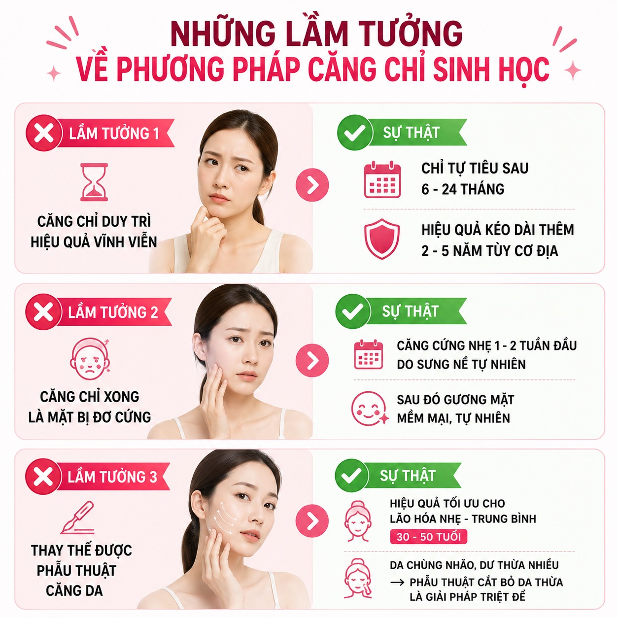 Căng chỉ sinh học là gì? Giữ được bao lâu và có an toàn không? căng chỉ sinh học