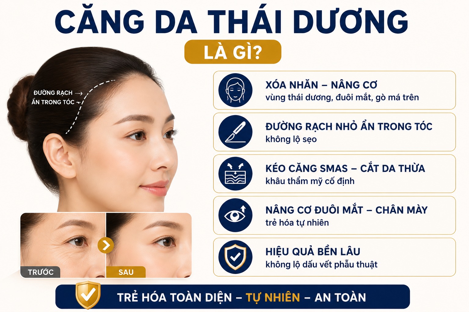 Căng da thái dương: Bí quyết xóa sổ nếp nhăn, nâng cơ mắt chảy xệ Căng da thái dương là gì?