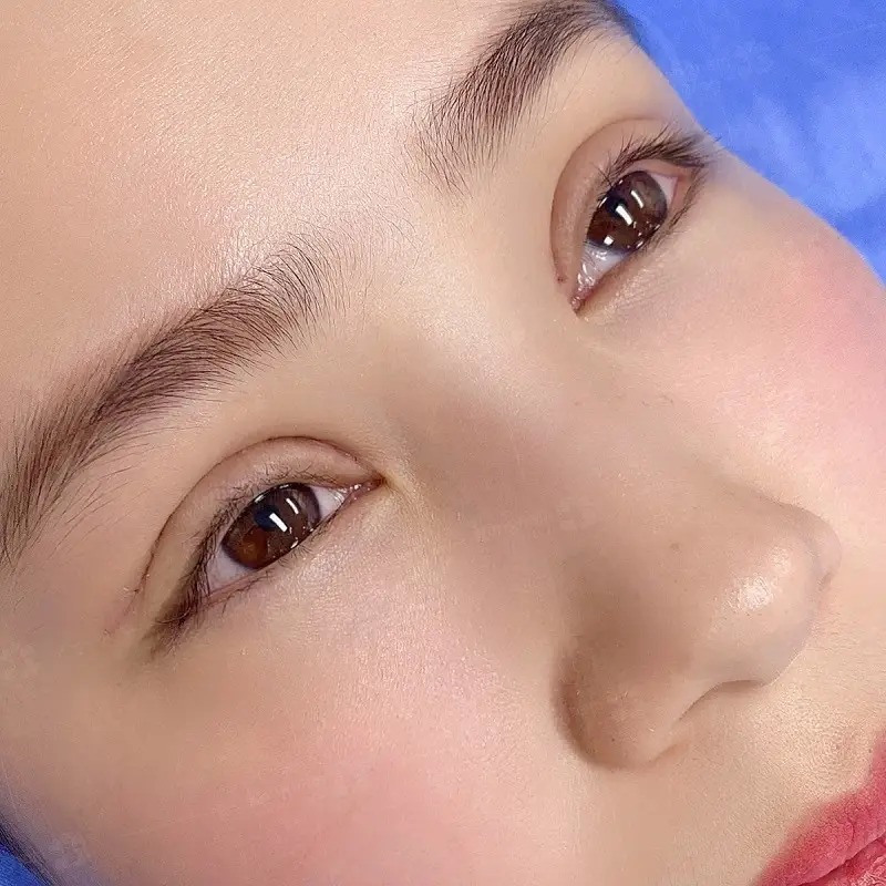 Which method should I choose: full or mini eyelid surgery? cắt mí full và mini