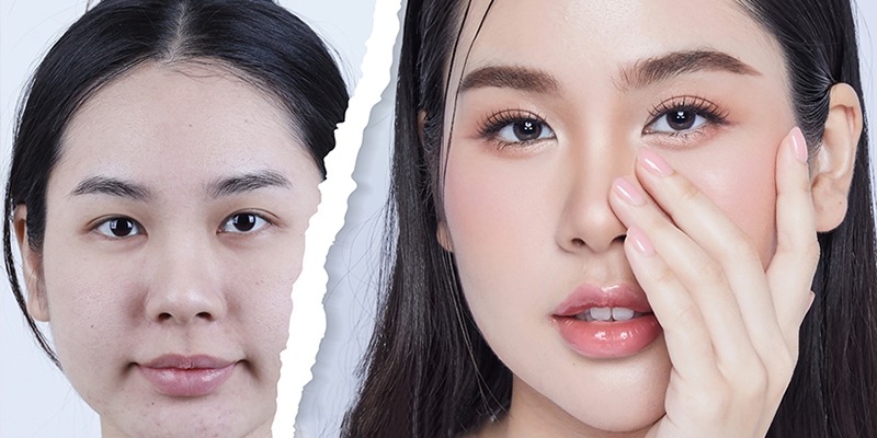 Which method should I choose: full or mini eyelid surgery? cắt mí full và mini