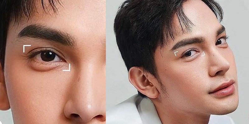 Cắt mí nam: Giải pháp cải thiện mắt một mí, sụp mí và mí không đều Đối tượng phù hợp với cắt mí nam giới