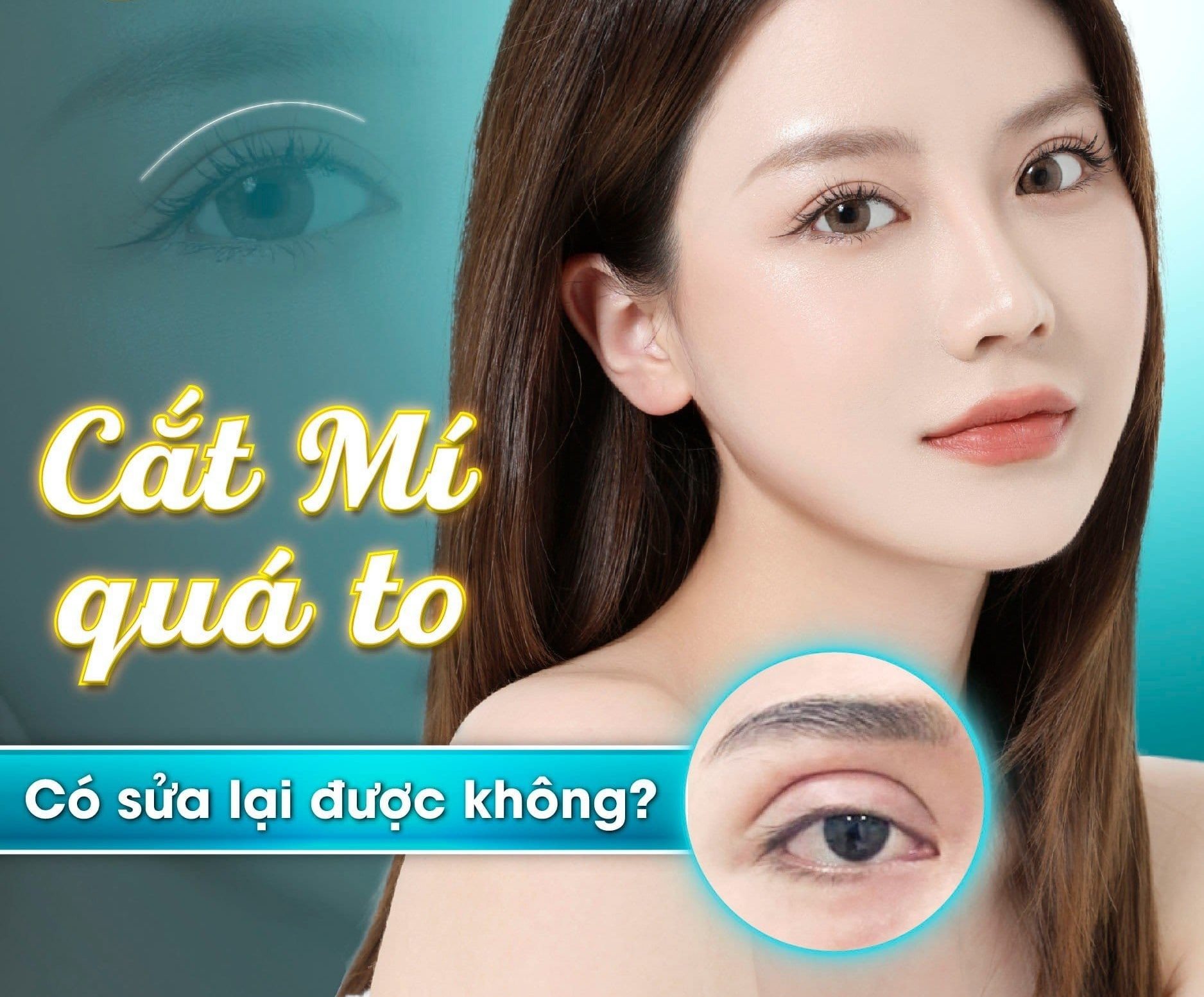 Cắt mí quá to có sửa được không? Cách khắc phục hiệu quả cắt mí quá to có sửa được không