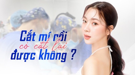 Can eyelid surgery be redone after it has already been performed? Cắt mí rồi có cắt lại được không?