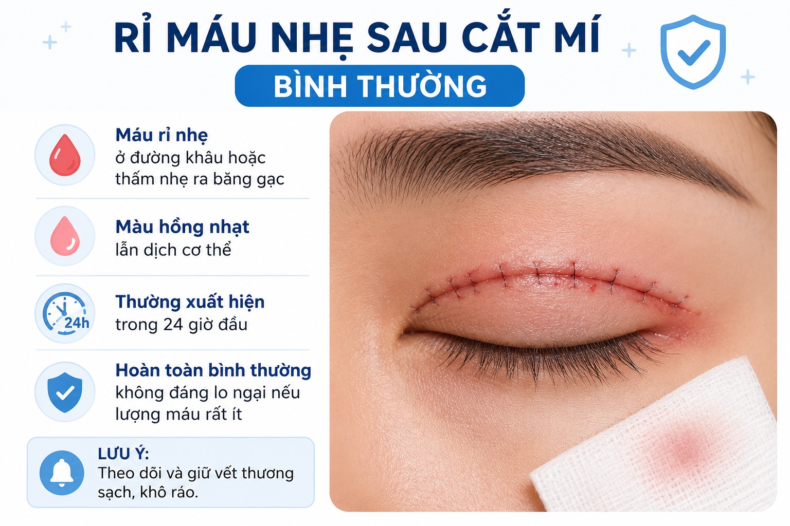 Cắt mí về bị chảy máu có nguy hiểm không? Nguyên nhân & Cách khắc phục Cắt mí về bị chảy máu