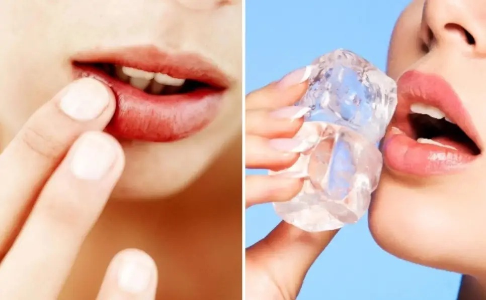 How long does it take for swelling to go down after lip surgery? cắt môi bao lâu hết sưng