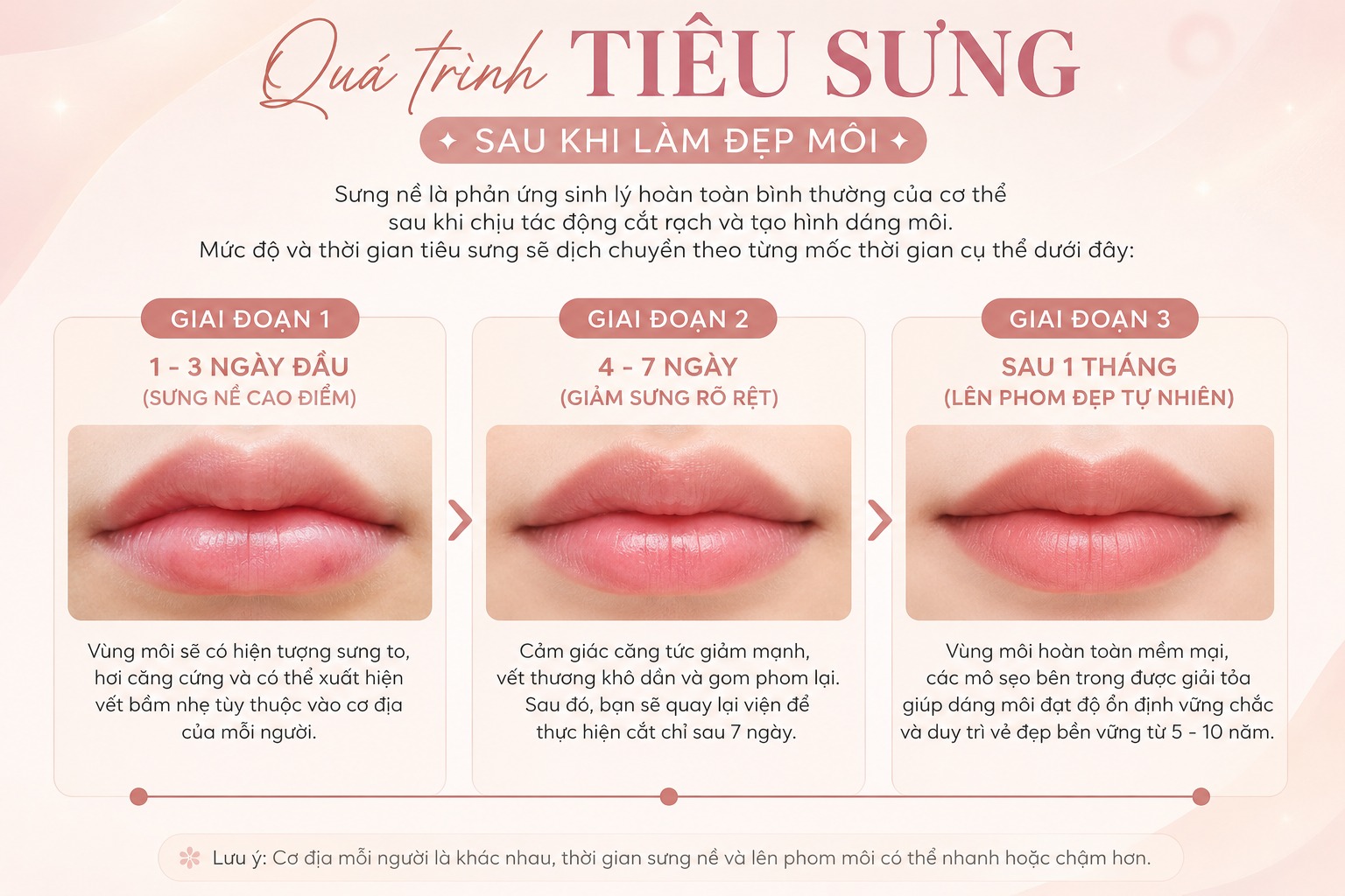 How long does it take for swelling to go down after lip surgery? cắt môi bao lâu hết sưng