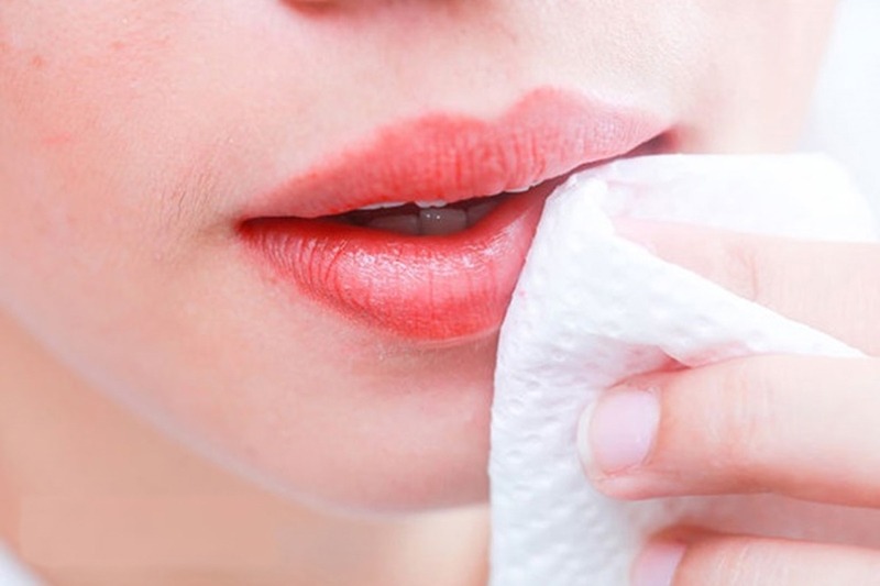 Phẫu thuật cắt môi dày có được vĩnh viễn không? cắt môi dày có vĩnh viễn không