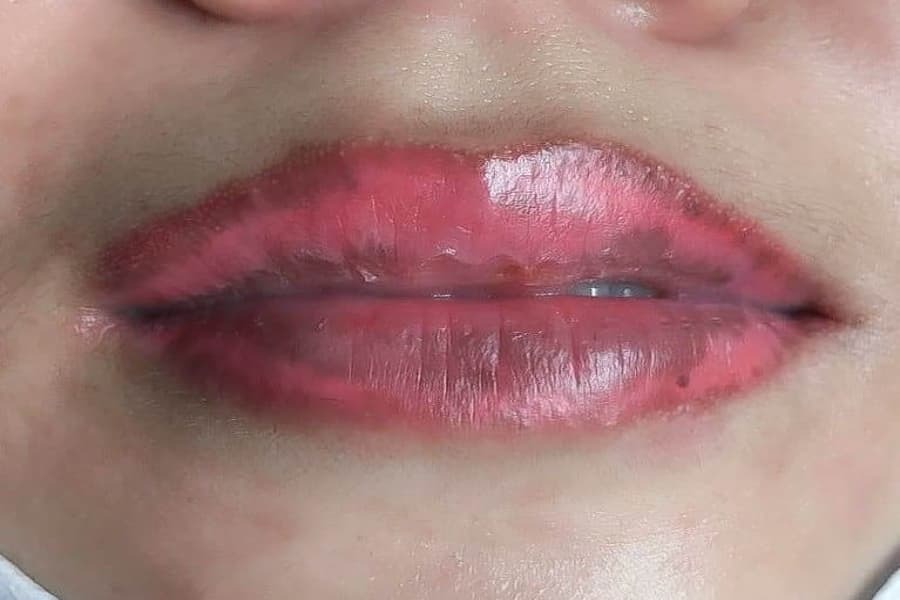 Hướng dẫn chăm sóc môi sau khi cắt giúp môi nhanh lành, lên phom chuẩn chăm sóc môi sau khi cắt