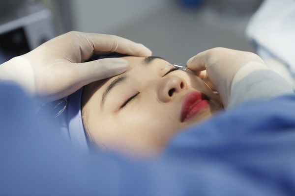 Do eyelid sutures dissolve on their own? chỉ nhấn mí có tự tiêu không