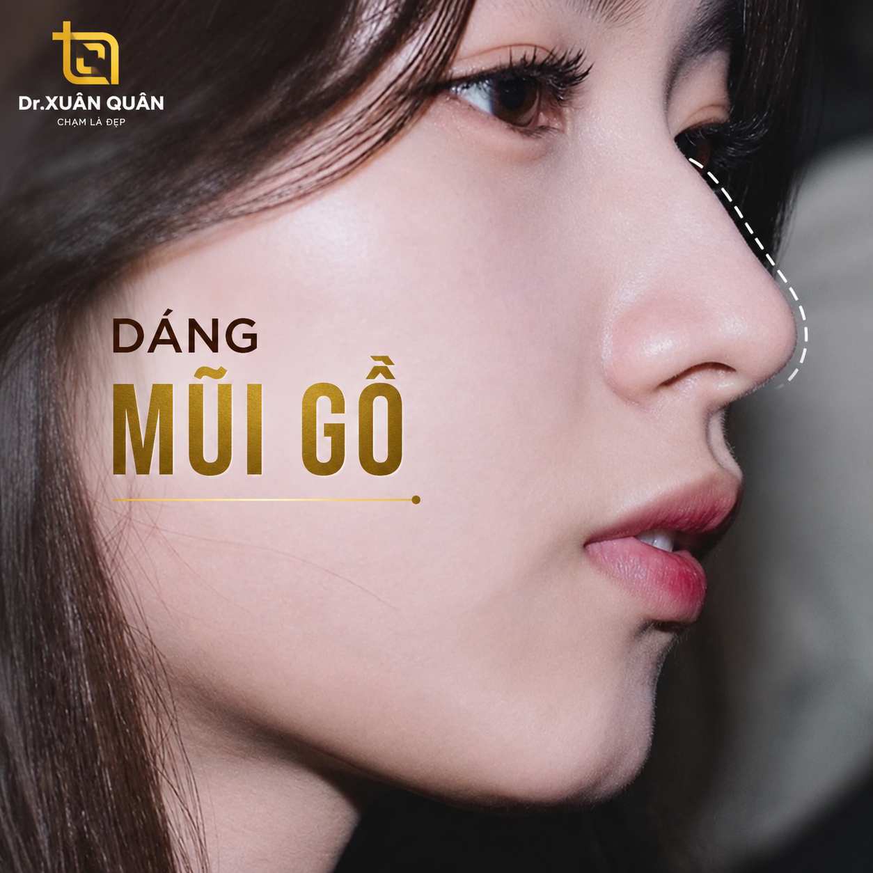 Mài gồ xương mũi Thăm khám và phân tích cấu trúc mũi