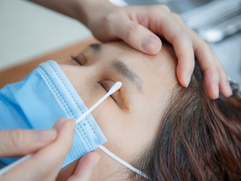 Essential information you should know about eyelid surgery from Dr. Xuan Quan Kinh nghiệm đi cắt mí mắt - Vệ sinh sau khi cắt mí mắt