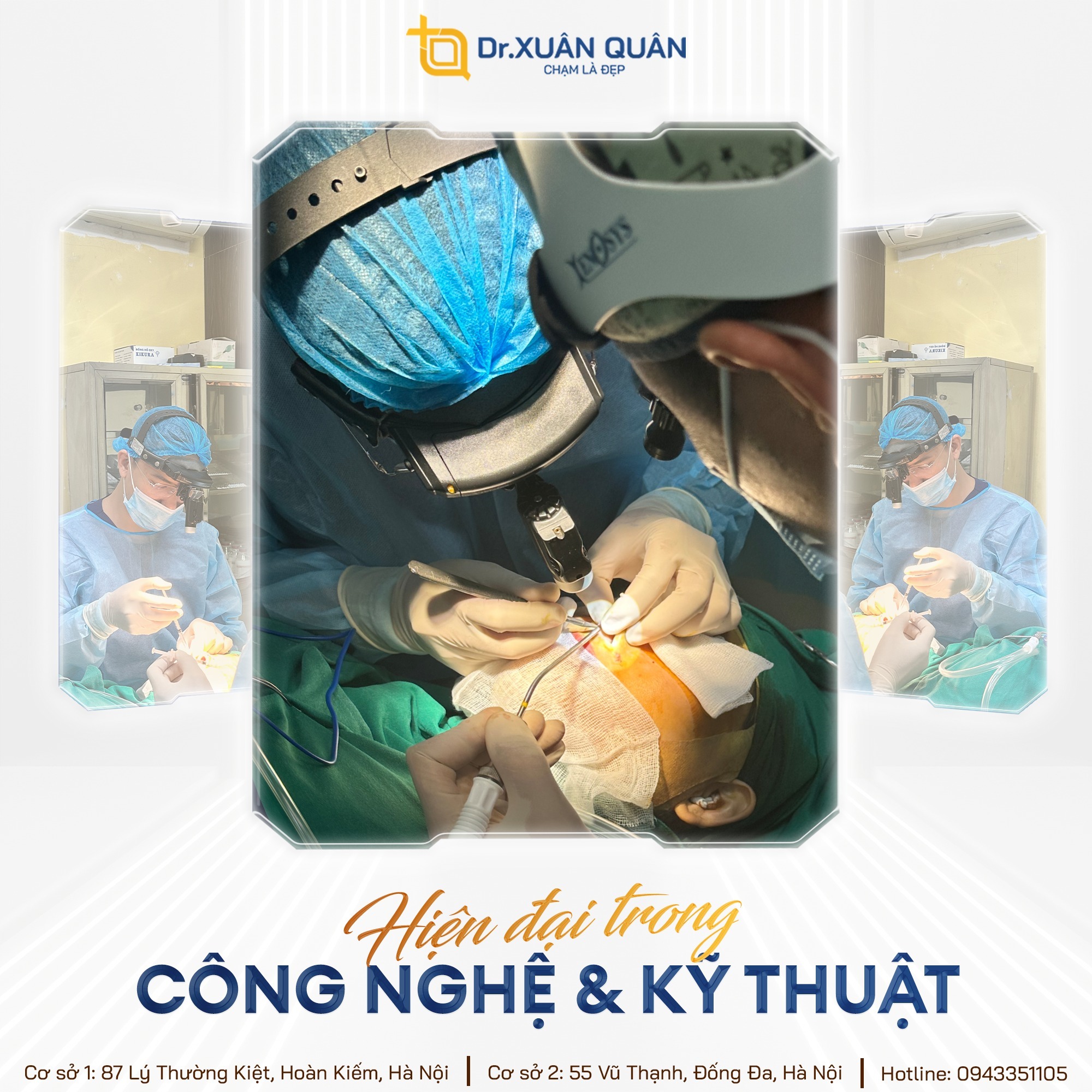 Methods to improve a low nasal bridge Thẩm mỹ Dr Xuân Quân - Kinh nghiệm phẫu thuật thẩm mỹ chuyên sâu