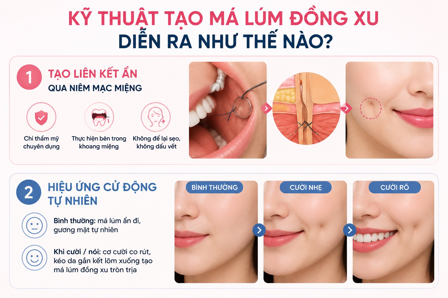 Kỹ thuật tạo má lúm đồng xu diễn ra như thế nào?