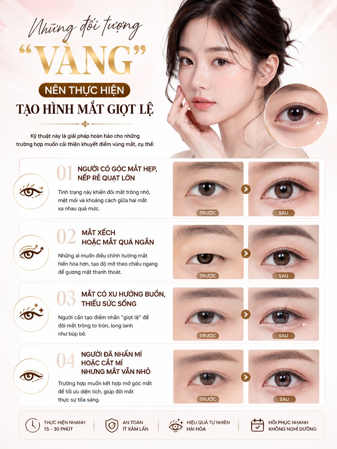 Mở góc mắt giọt lệ là gì? Kỹ thuật tạo đôi mắt to tròn, long lanh Đối tượng nên thực hiện mắt giọt lệ