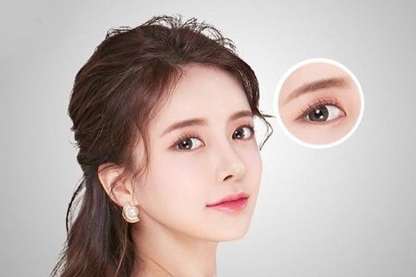 Mở góc mắt giọt lệ là gì? Kỹ thuật tạo đôi mắt to tròn, long lanh Những câu hỏi thường gặp về mở mắt giọt lệ