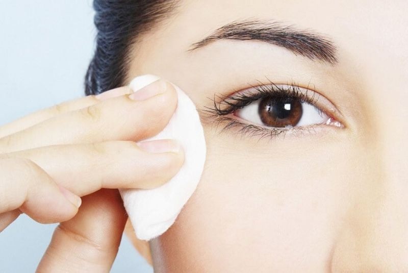 Mở góc mắt Chăm sóc sau phẫu thuật mở góc mắt