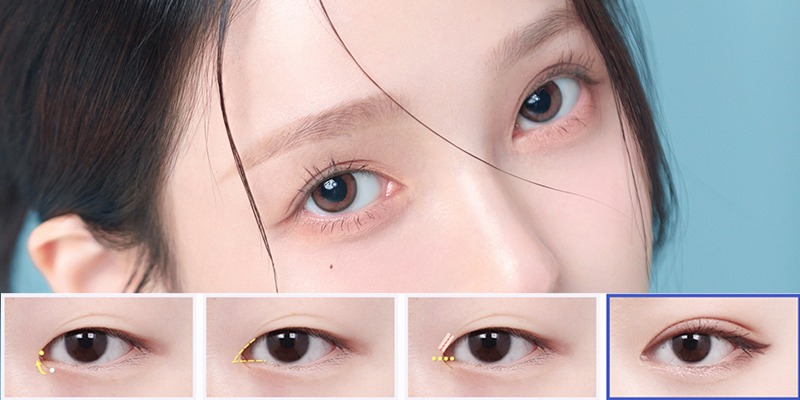 Mở rộng góc mắt có đau không? Bao lâu hồi phục? Mở rộng góc mắt có đau không?