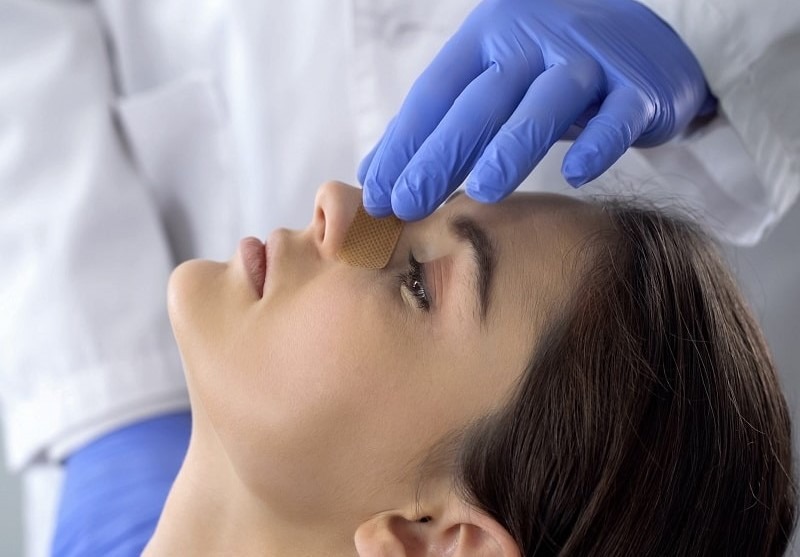 What is nasal capsular contracture? Causes and treatment mũi bị bao xơ là gì