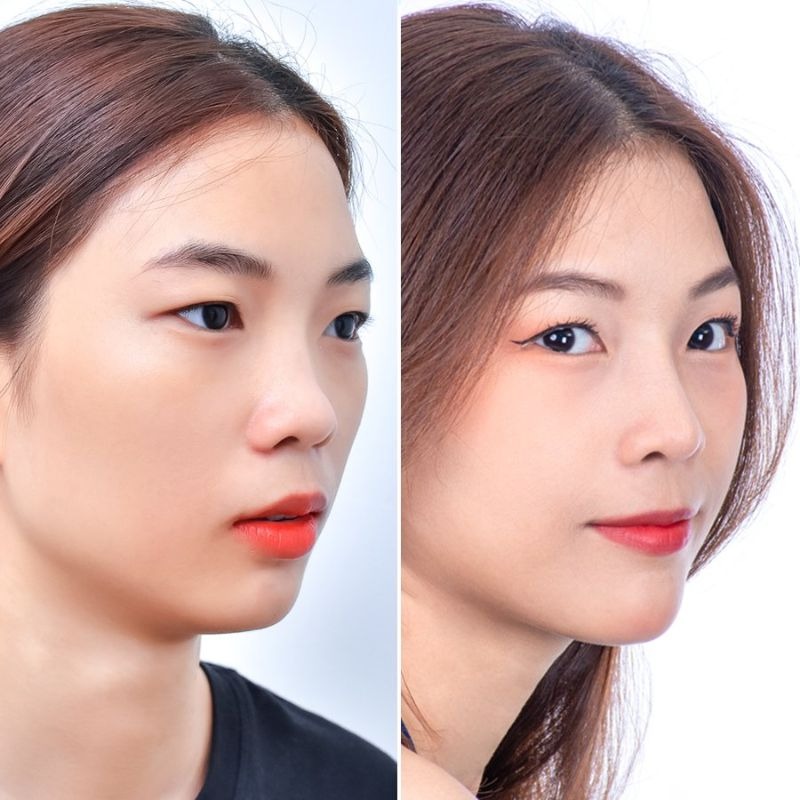 Cách phân biệt mũi cao và mũi tẹt dễ nhận biết