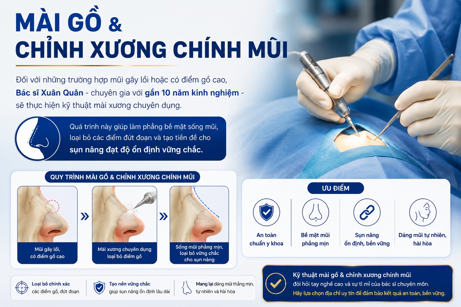 Mũi gãy là gì? Nguyên nhân và giải pháp khắc phục từ chuyên gia mũi gãy là gì
