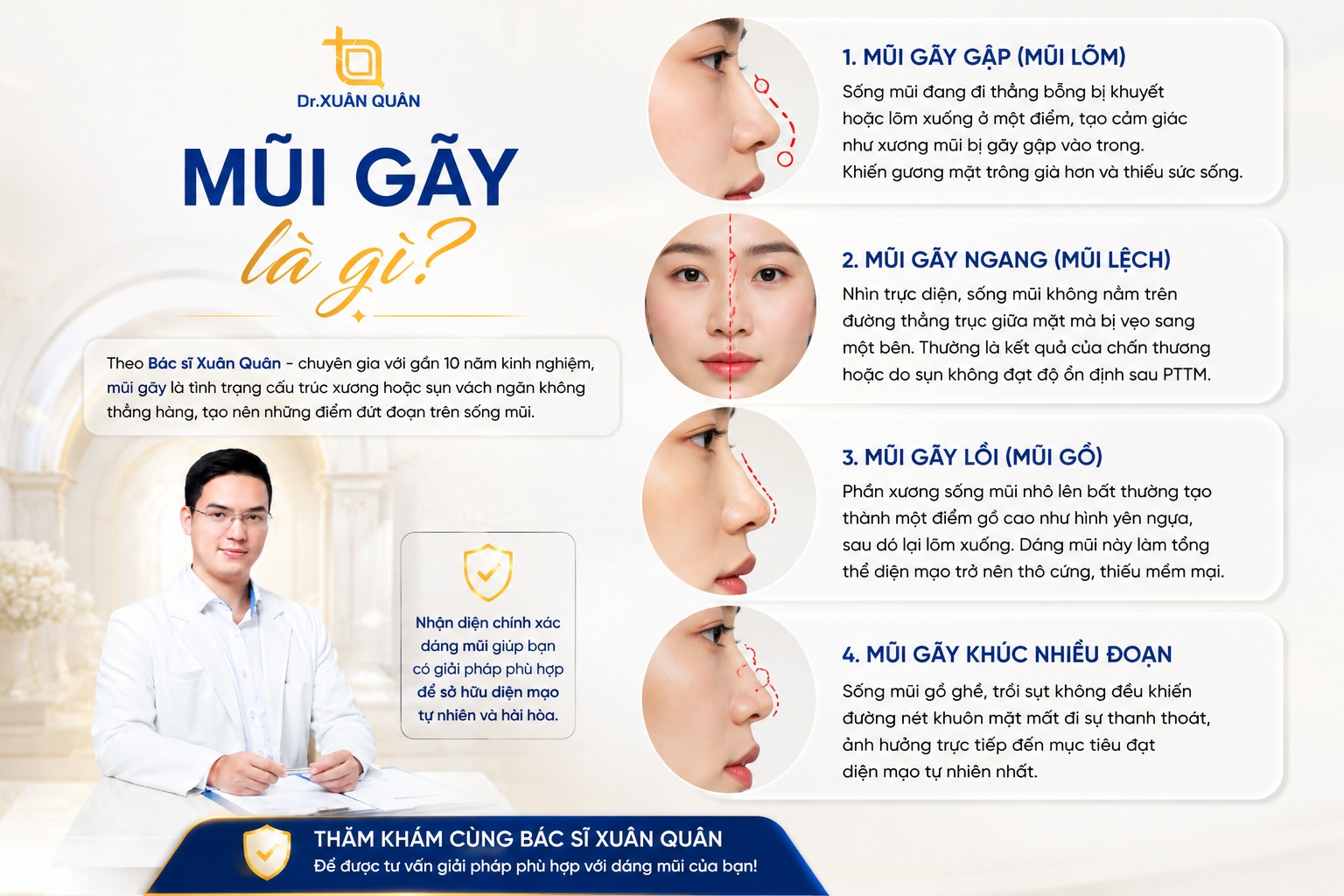 Mũi gãy là gì? Nguyên nhân và giải pháp khắc phục từ chuyên gia mũi gãy là gì