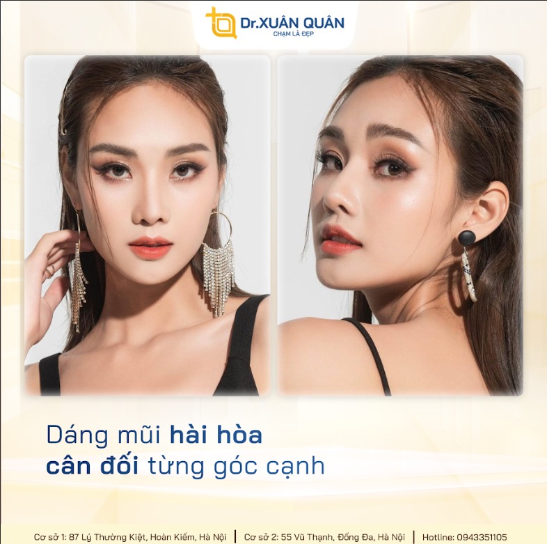 Is nose tip reduction permanent? Answers from a cosmetic surgeon Thu nhỏ đầu mũi có vĩnh viễn không