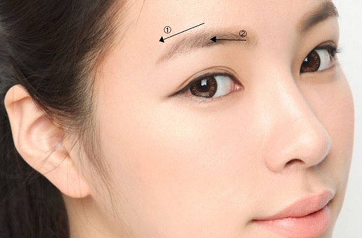 Nâng cung mày có sẹo không? Bao lâu thì mờ? nâng cung mày có sẹo không