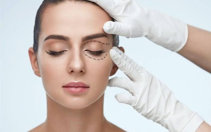 Nâng cung mày có sẹo không? Bao lâu thì mờ? Nâng cung mày có sẹo không?