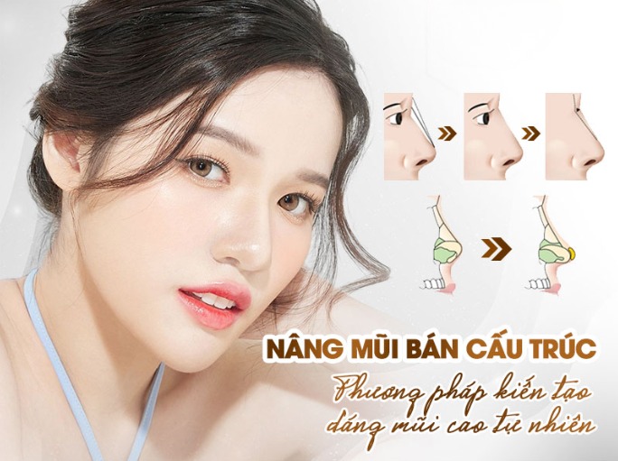 What is semi-structural rhinoplasty? Advantages and suitable candidates Nâng mũi bán cấu trúc