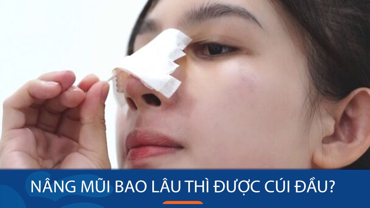 Nâng mũi bao lâu thì được cúi đầu & những tư thế sinh hoạt chuẩn y khoa nâng mũi bao lâu thì được cúi đầu
