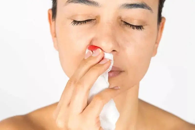 Nâng mũi bị chảy máu có nguy hiểm không? Cách xử lý an toàn từ chuyên gia Phân biệt hiện tượng nâng mũi bị chảy máu