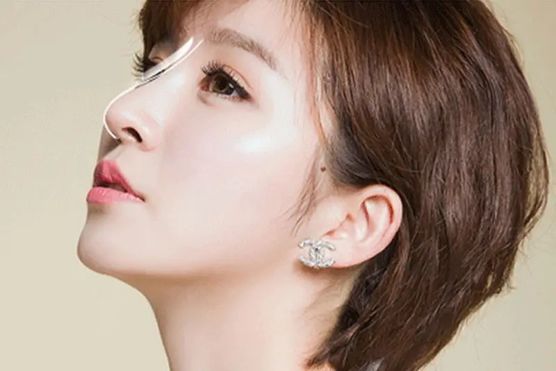Nâng mũi cấu trúc Sline Nâng mũi cấu trúc Sline