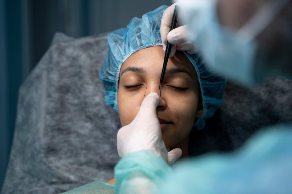 Comparison of structural and semi-structural rhinoplasty Nâng mũi cấu trúc và bán cấu trúc
