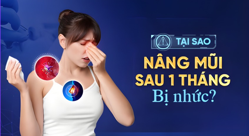 Nguyên nhân khiến nâng mũi sau 1 tháng vẫn bị nhức