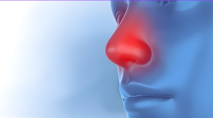 Nâng mũi sau 1 tháng vẫn bị nhức có bình thường không?