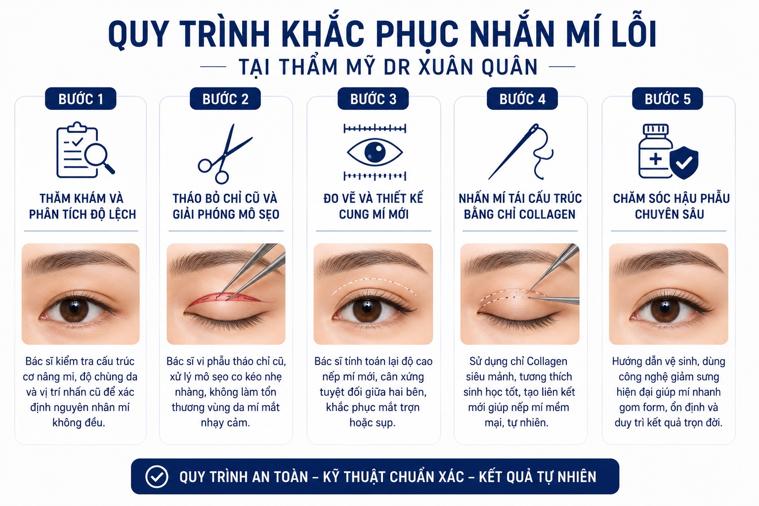 Nguyên nhân và cách khắc phục nhấn mí bị lệch hiệu quả nhấn mí bị lệch