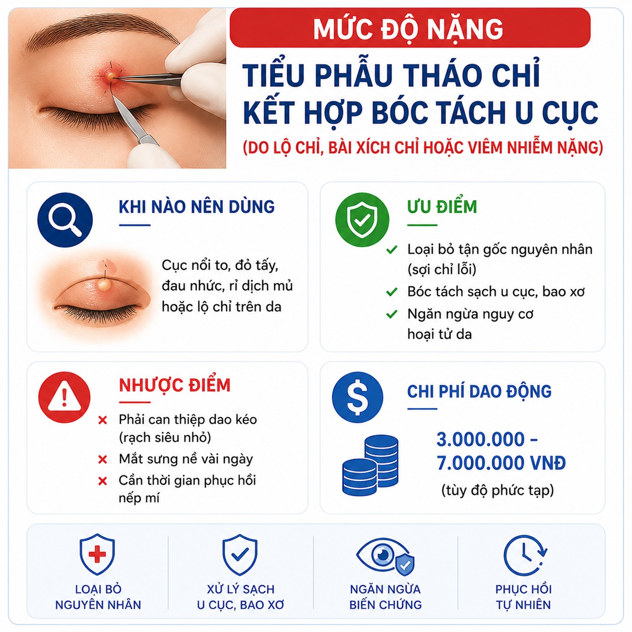 Nhấn mí bị nổi cục: Nguyên nhân, dấu hiệu nguy hiểm và cách xử lý dứt điểm nhấn mí bị nổi cục