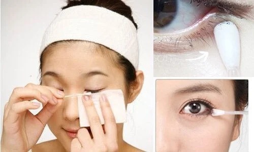Nhấn mí sưng bao lâu thì hết và đẹp tự nhiên? 5 cách giảm sưng nhanh, an toàn nhấn mí sưng bao lâu thì hết