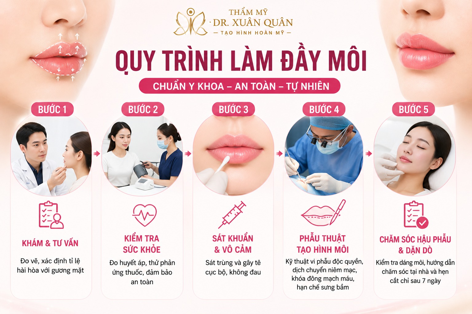 Phẫu thuật môi mỏng thành dày: Bí quyết sở hữu bờ môi quyến rũ phẫu thuật môi mỏng thành dày