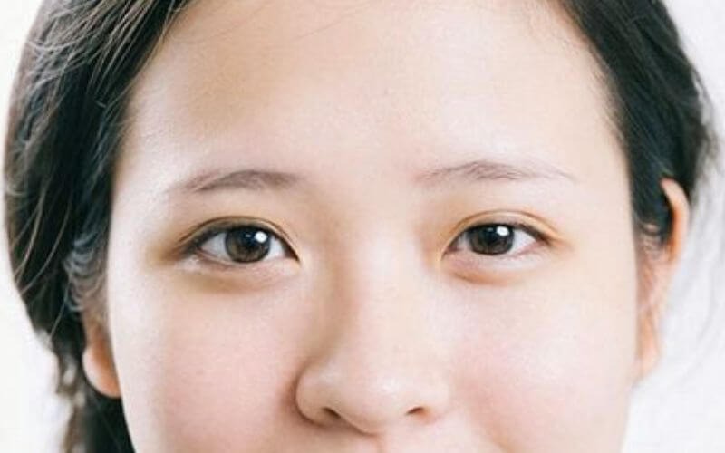 Địa chỉ phẫu thuật thẩm mỹ mắt to mắt nhỏ tốt nhất hiện nay phẫu thuật thẩm mỹ mắt to mắt nhỏ
