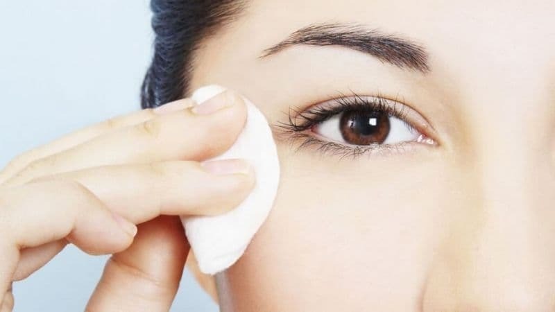 Bị phù kết mạc sau cắt mí có nguy hiểm không? Bao lâu thì hết? phù kết mạc sau cắt mí