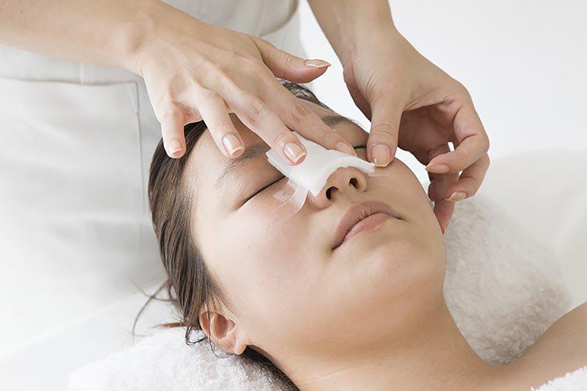 Nâng mũi bị chảy máu có nguy hiểm không? Cách xử lý an toàn từ chuyên gia nâng mũi bị chảy máu