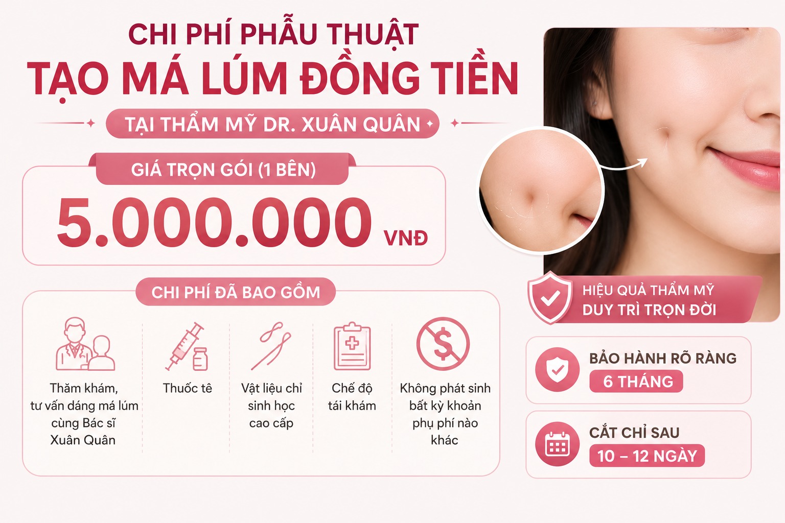 tạo má lúm đồng tiền