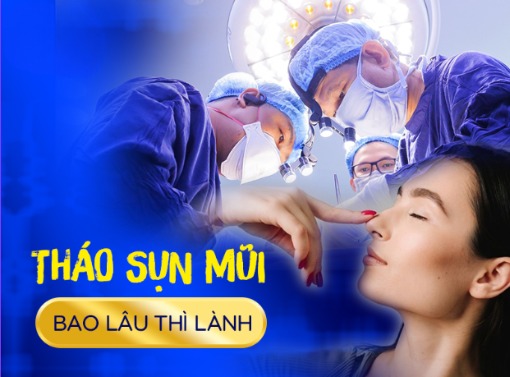 Tháo sụn mũi Tháo sụn mũi bao lâu thì lành?