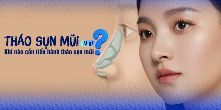 Tháo sụn mũi Những trường hợp nên tháo sụn mũi