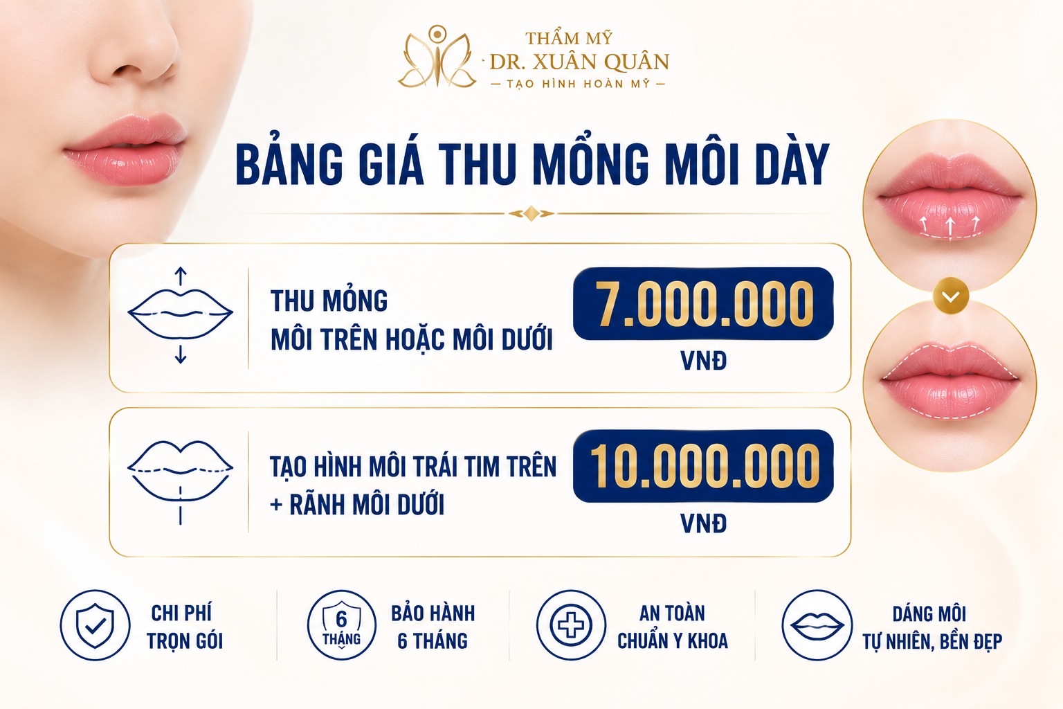 Thu mỏng môi dày giá bao nhiêu? Bảng giá tạo hình môi mới nhất thu mỏng môi dày giá bao nhiêu