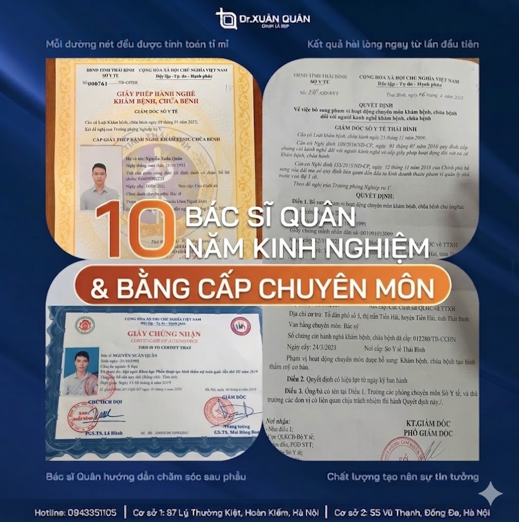 thu nhỏ đầu mũi bao lâu hết sưng